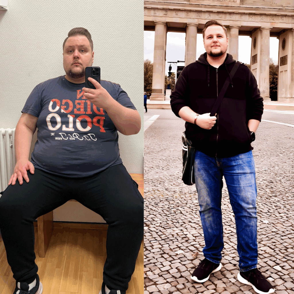 David Before & After