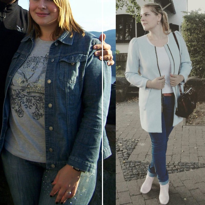 Before and after, customer with lipedema